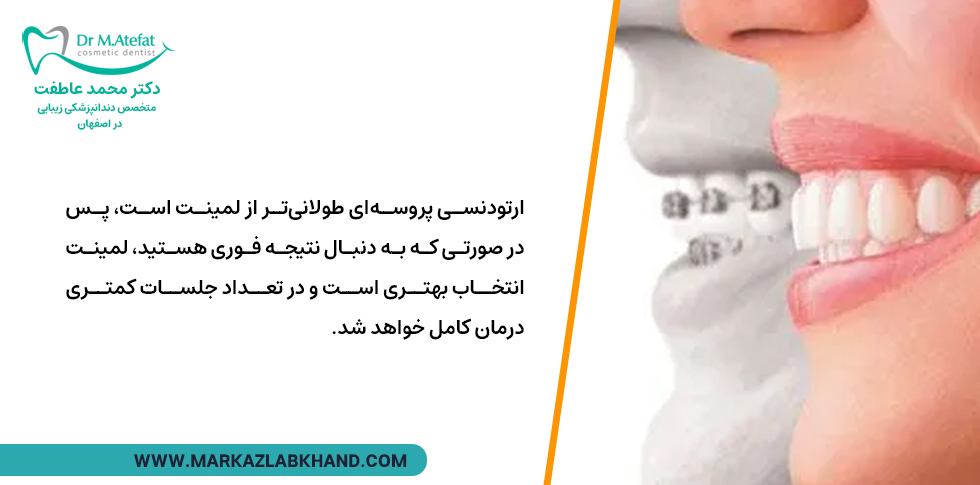 تفاوت لمینت و ارتودنسی در مدت زمان درمان