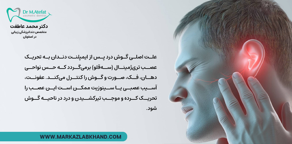 عصب تری‌ژمینال (یا سه‌قلو) و درد گوش بعد از ایمپلنت