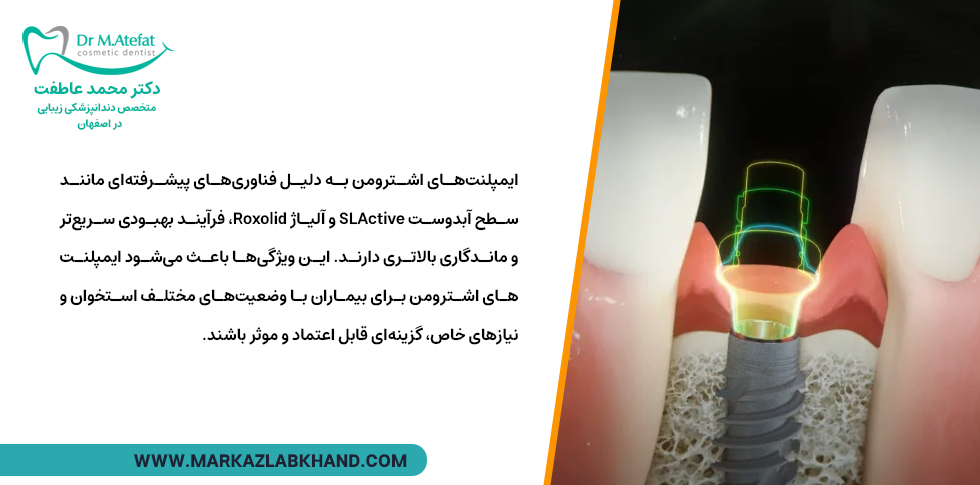 مزایای ایمپلنت های سوئیسی اشترومن