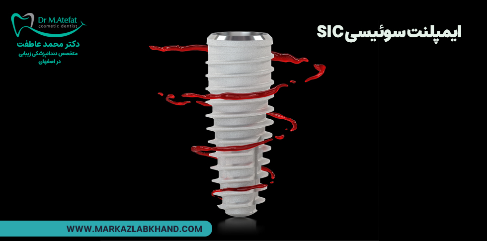 ایمپلنت سوئیسی SIC