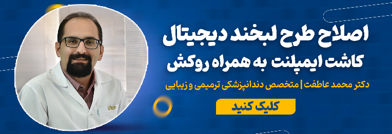 تماس با مرکز دندانپزشکی زیبایی و کاشت ایمپلنت دکتر محمد عاطفت اصفهان
