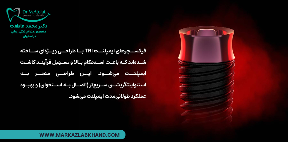 ویژگی های ایمپلنت سوئیسی TRI