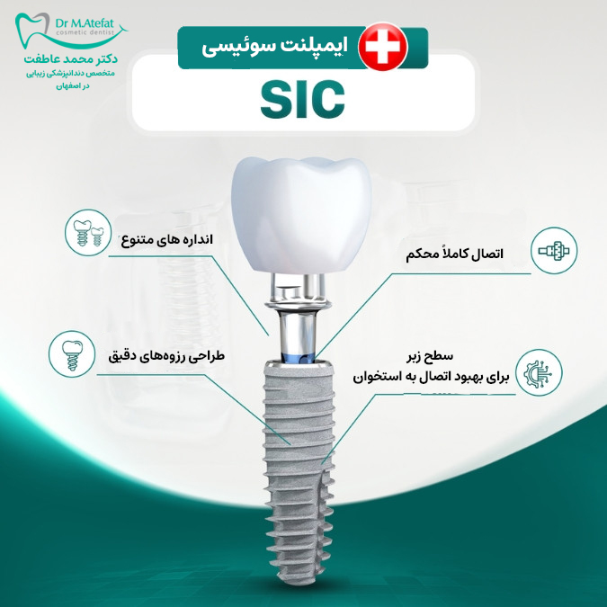 برتری های ایمپلنت سوئیسی SIC
