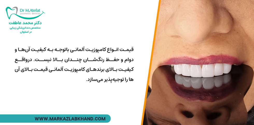 قیمت انواع کامپوزیت های آلمانی