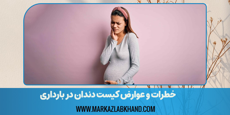 خطرات و عوارض کیست دندان در بارداری