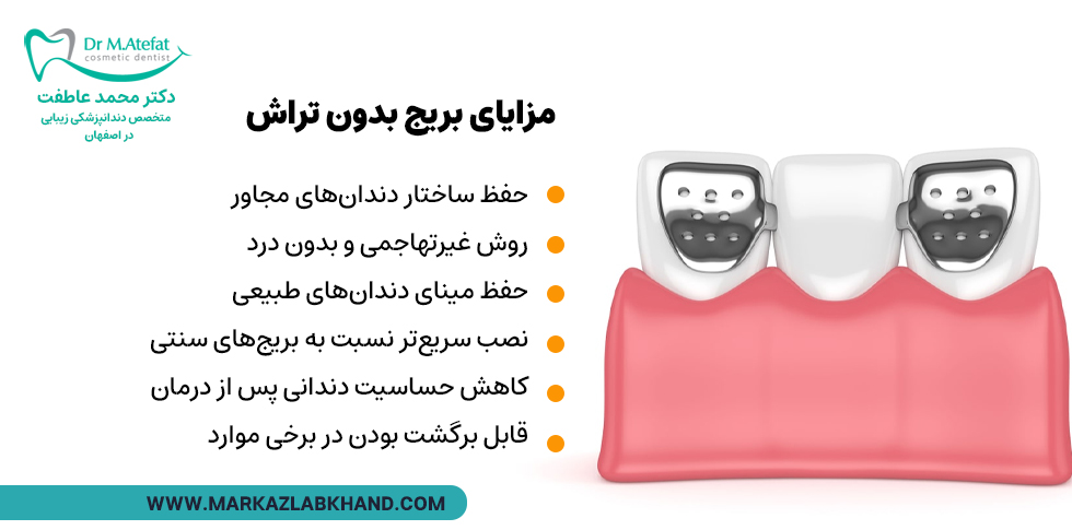 مزایای بریج دندان بدون تراش