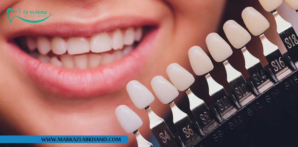 تفاوت های لمینت سرامیکی و بلیچینگ دندان