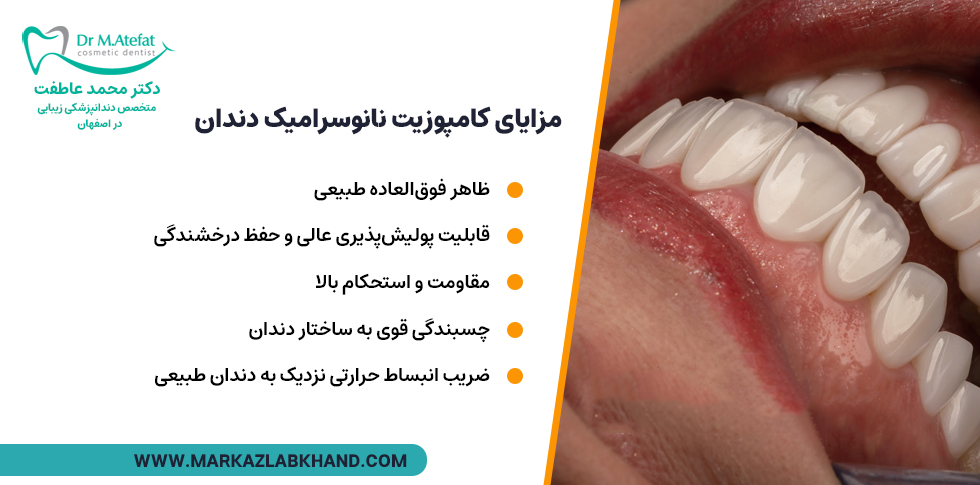 مزایای کامپوزیت نانوسرامیک