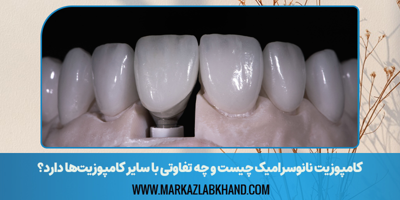 کامپوزیت نانوسرامیک چیست و چه تفاوتی با سایر کامپوزیت‌ها دارد؟
