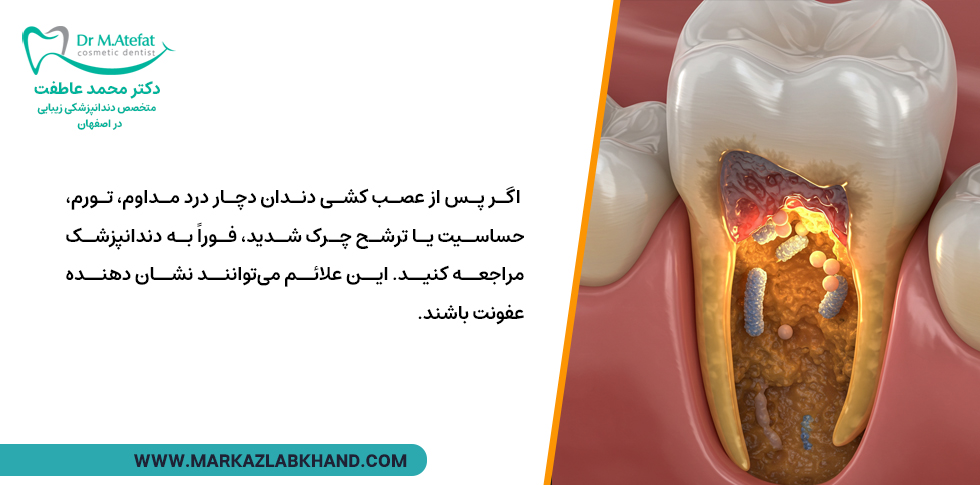 درمان عفونت دندان عصب کشی شده