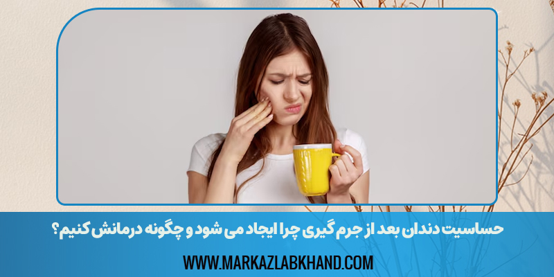 حساسیت دندان بعد از جرم گیری