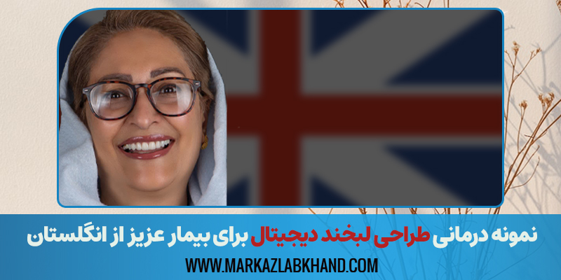 نمونه درمانی طراحی لبخند دیجیتال برای بیمار عزیز از انگلستان