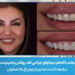 اصلاح طرح لبخند و جراحی لثه در اصفهان