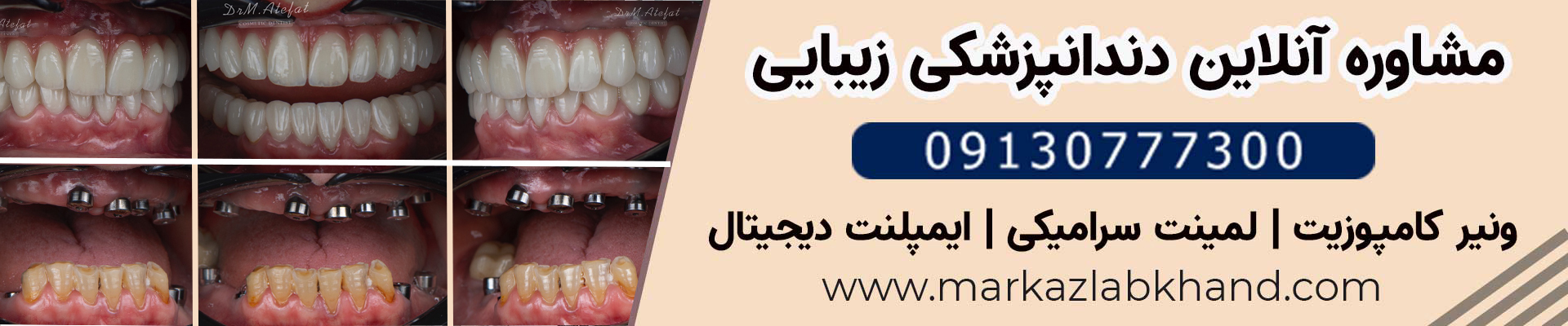 تماس با مطب دکتر محمد عاطفت، بهترین متخصص ایمپلنت در اصفهان
