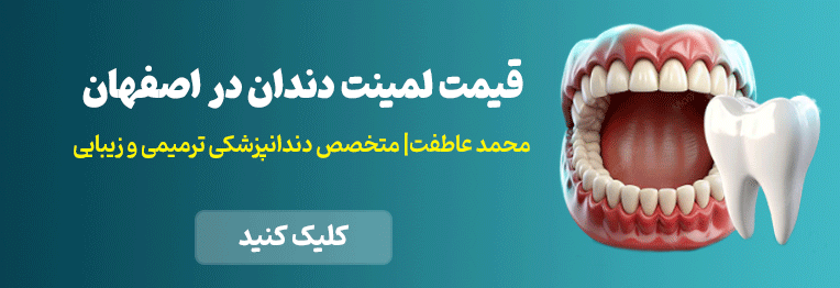 قیمت لمینت دندان در اصفهان