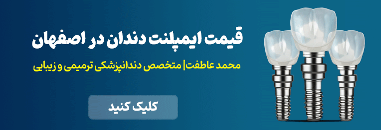 قیمت ایمپلنت دندان در اصفهان