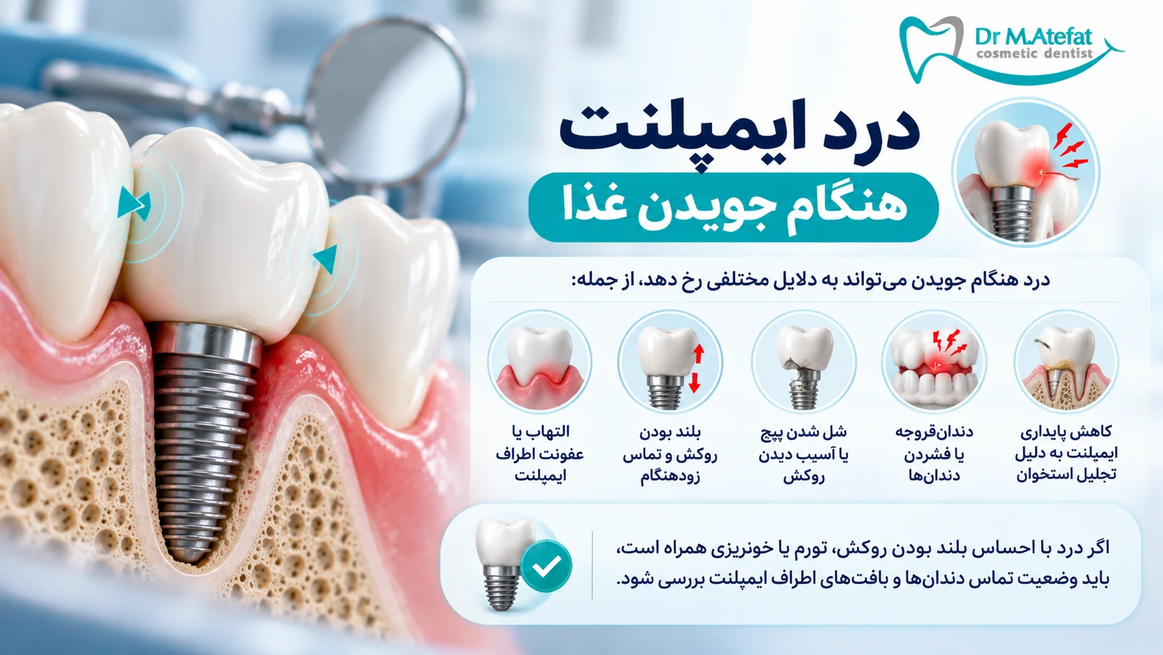 درد ایمپلنت هنگام جویدن غذا
